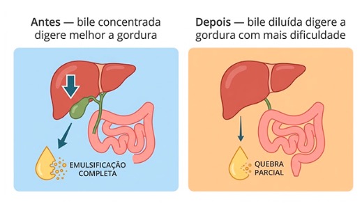 Alimentação pós retirada da vesícula: como adaptar a dieta para viver bem