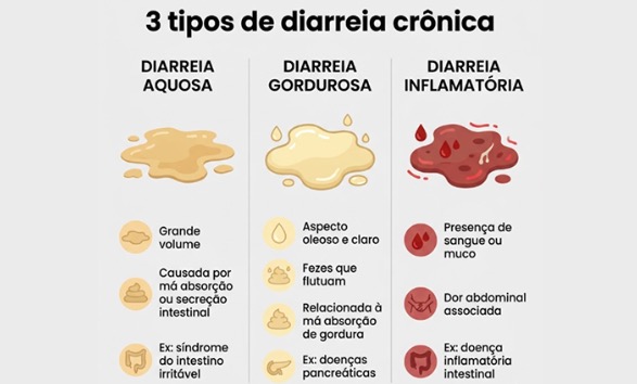 Diarreia crônica: por que o sintoma persiste e como investigar a causa