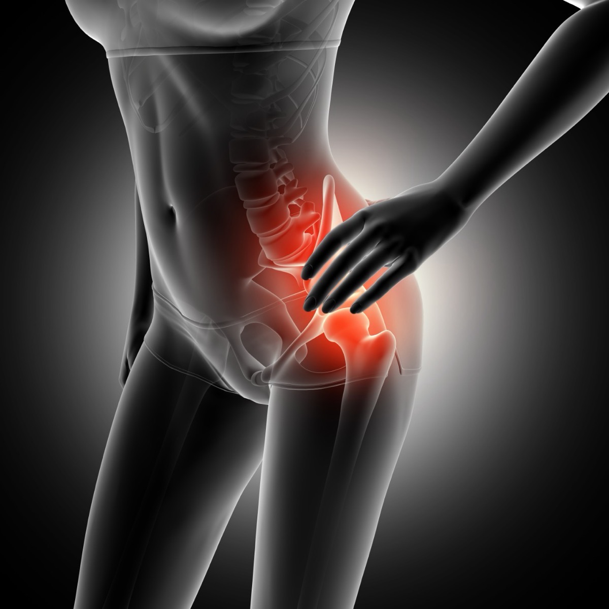 Dores NA virilha: Hérnia inguinal OU pode SER A articulação DO quadril?