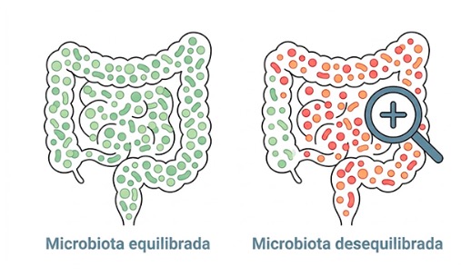 Exame de disbiose: como descobrir se sua microbiota está em desequilíbrio