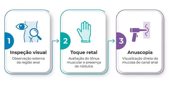 Exame proctológico: entenda cada etapa e perca o medo de vez