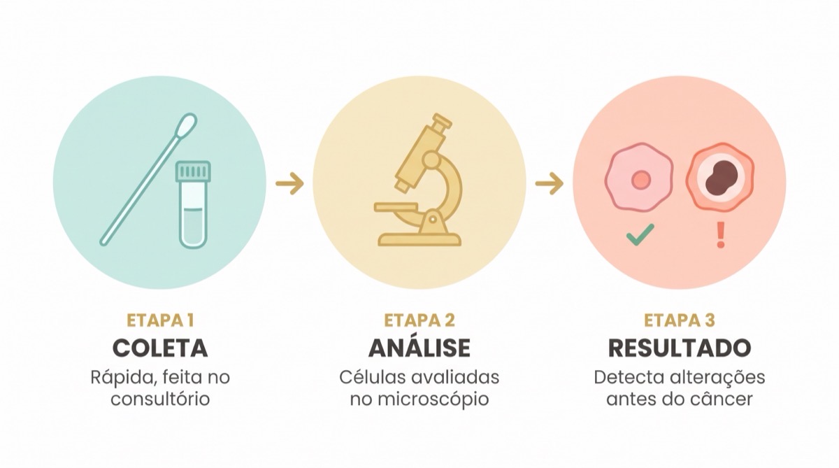 Papanicolau anal, o exame simples que pode prevenir o câncer de ânus