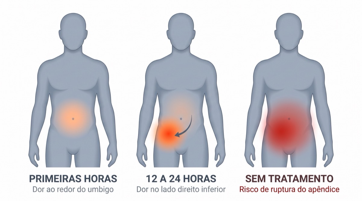 Sintomas de apendicite: como a dor evolui e por que cada hora conta