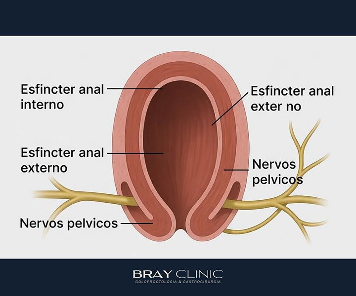 Incontinência fecal: o que causa, quais os sintomas e como tratar