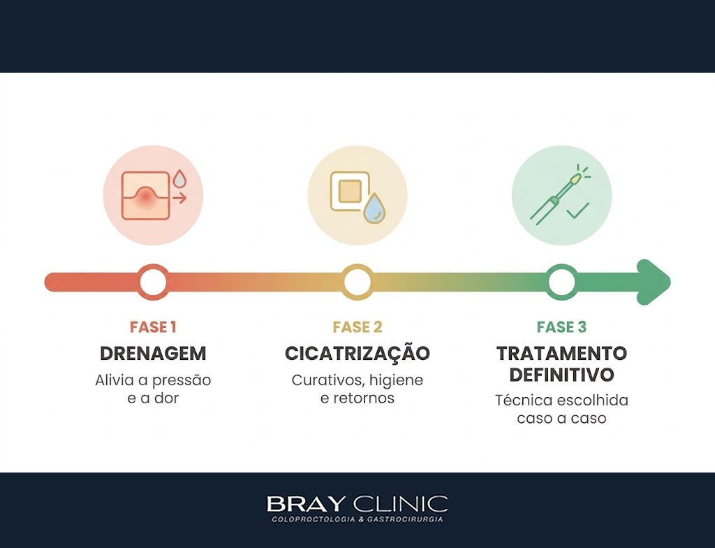 Abscesso pilonidal, entenda a crise aguda do cisto e por que a drenagem vem primeiro