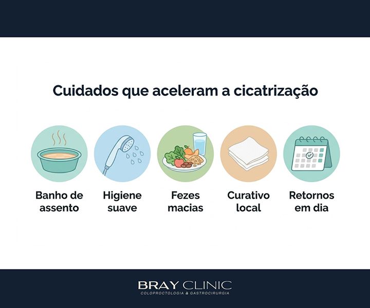 Cirurgia de fístula anal: o guia completo da recuperação até a cicatrização total