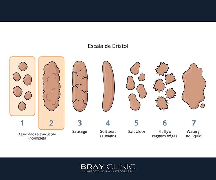 Evacuação incompleta: por que você sente que o intestino nunca esvazia
