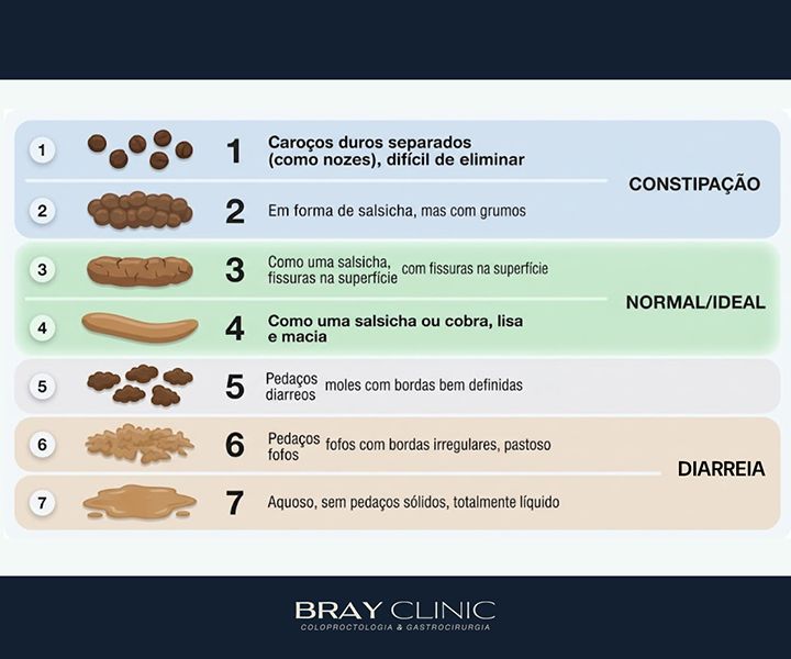 Constipação intestinal: o que causa, como tratar e quando procurar um especialista