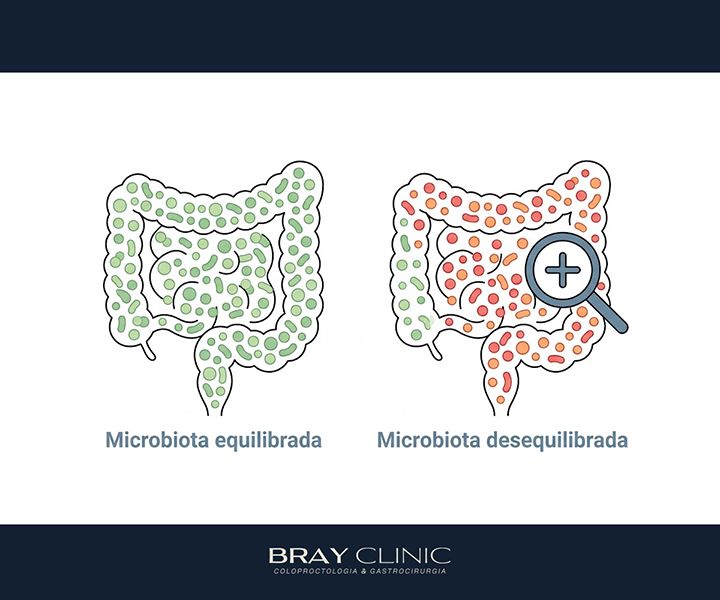 Exame de disbiose: como descobrir se sua microbiota está em desequilíbrio