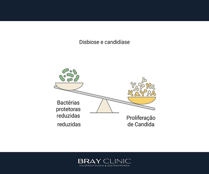 Exame de disbiose: como descobrir se sua microbiota está em desequilíbrio