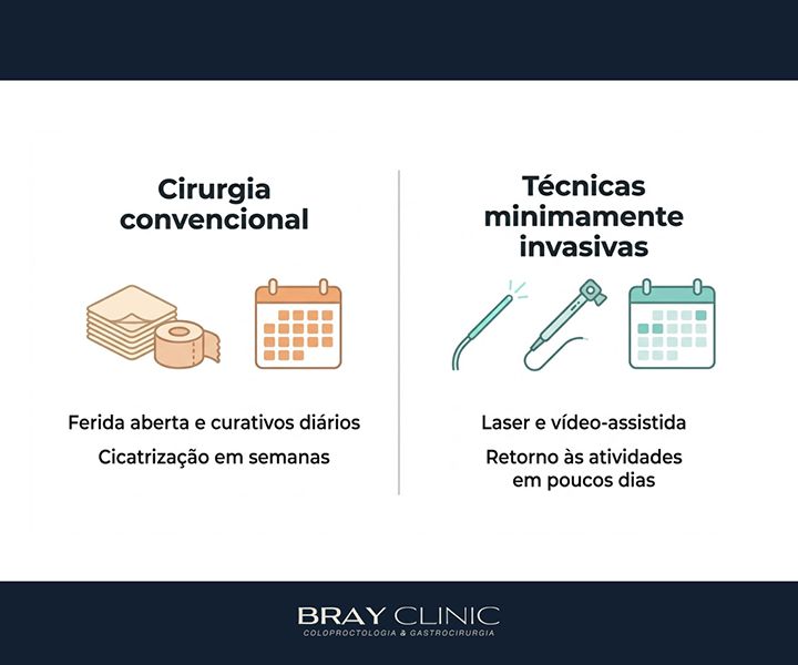 Cirurgia de fístula anal: o guia completo da recuperação até a cicatrização total