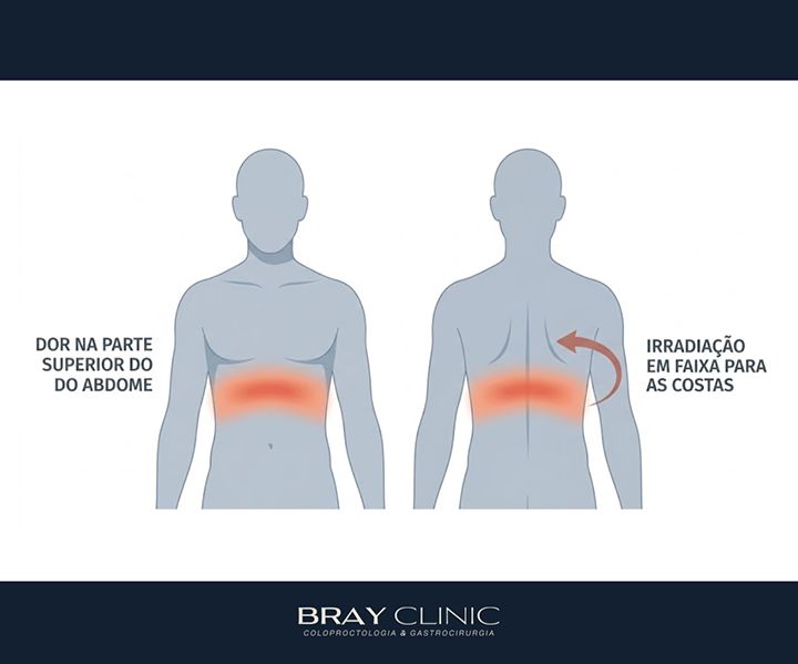 Pancreatite aguda: como reconhecer a emergência e o que acontece no tratamento