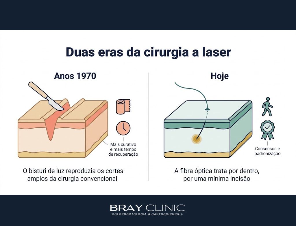 A história do laser na medicina, da teoria de Einstein à fibra óptica no consultório
