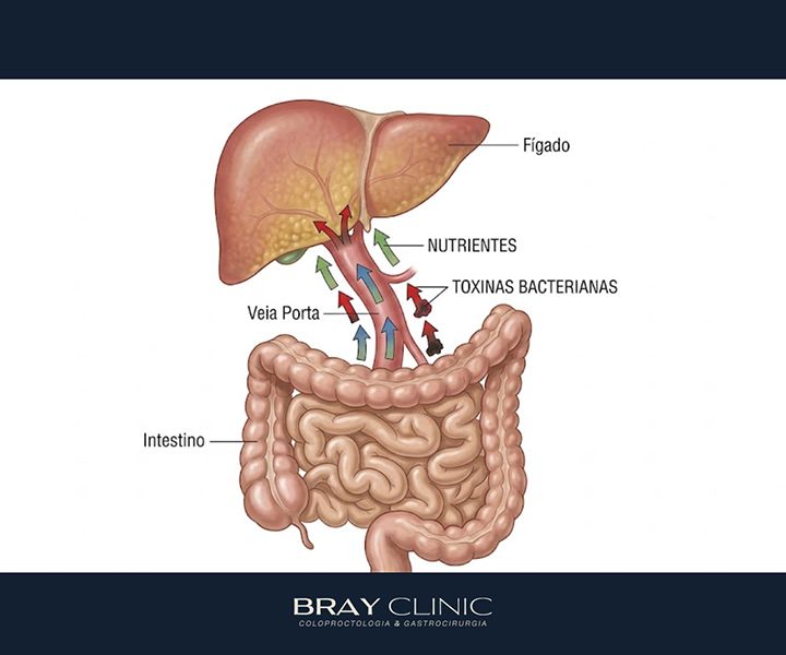 Esteatose hepática: como o fígado gorduroso conversa com o seu intestino