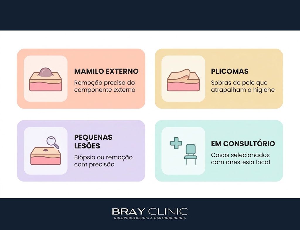 Laser de CO2 para hemorroidas, a precisão que muda o pós-operatório da cirurgia
