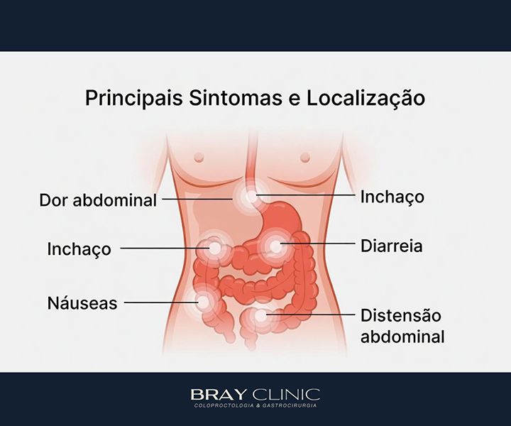 Ileíte: entenda a inflamação do íleo e saiba o que fazer após o diagnóstico
