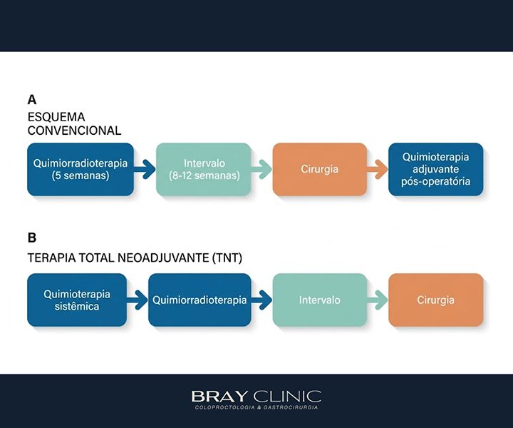 Por que preciso fazer quimioterapia e radioterapia antes de operar o câncer de reto?