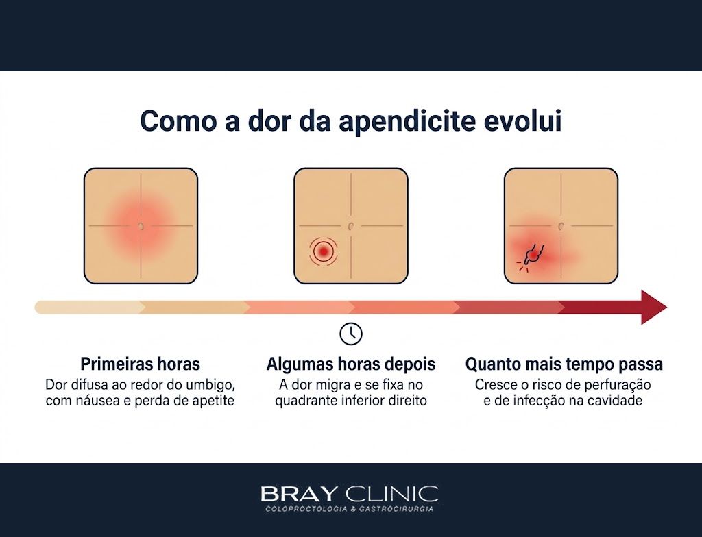 Sintomas de apendicite: como a dor evolui e por que cada hora conta