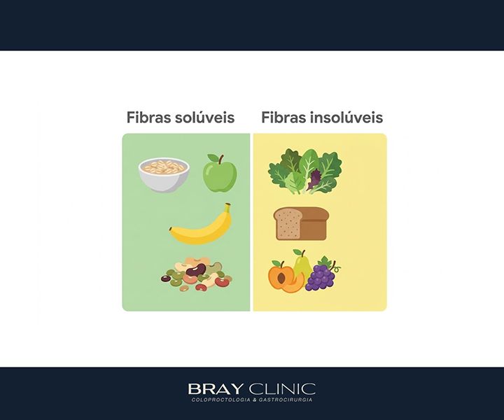 Alimentação pós retirada da vesícula: como adaptar a dieta para viver bem