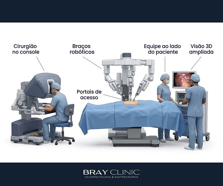 Cirurgia robótica na coloproctologia: o que muda para o paciente na prática