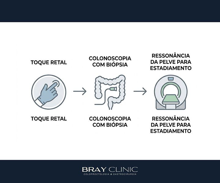 Câncer de reto: do diagnóstico à cirurgia, o que realmente esperar do tratamento