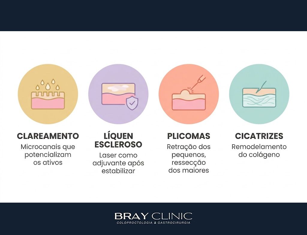 Estética íntima e a pele perianal, o que o laser resolve e o que precisa vir antes