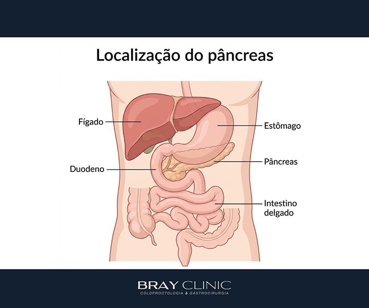 Pancreatite: entenda a inflamação no pâncreas e saiba como cuidar da sua saúde