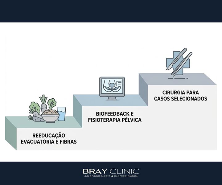 Síndrome da úlcera retal solitária: a lesão benigna que parece câncer no laudo
