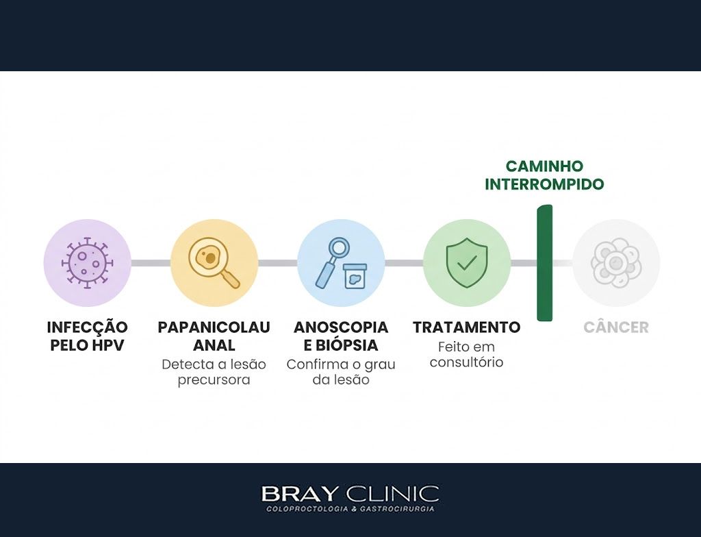 Papanicolau anal, o exame simples que pode prevenir o câncer de ânus