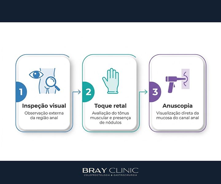 Exame proctológico: entenda cada etapa e perca o medo de vez