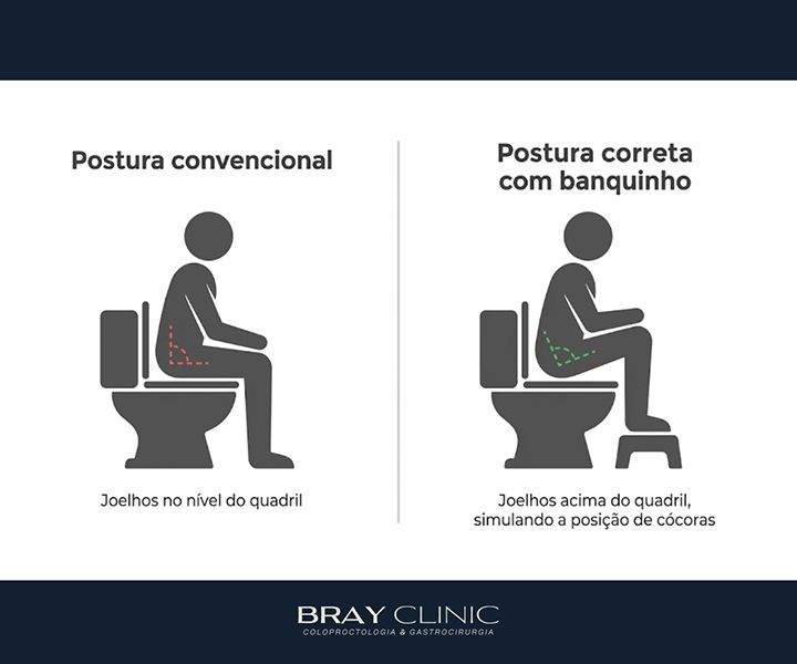 Evacuação incompleta: por que essa sensação acontece e o que fazer a respeito