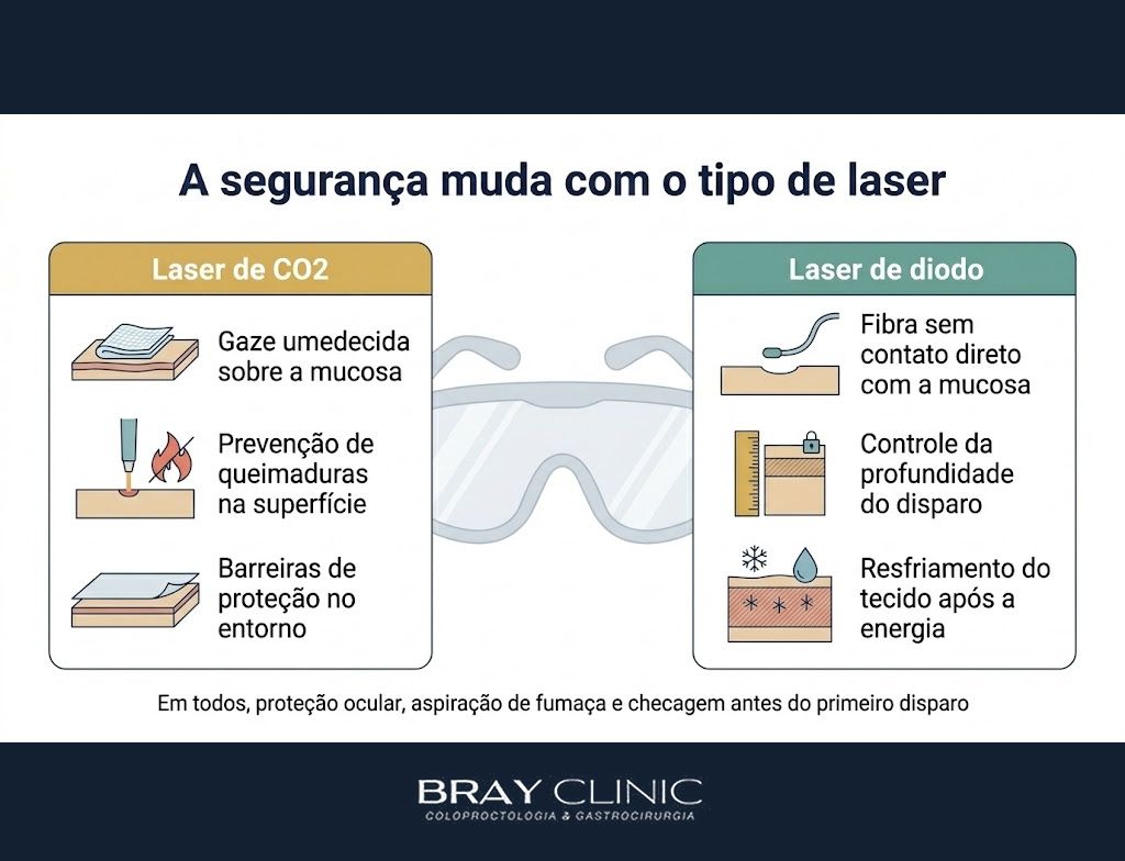 Tipos de laser na proctologia, por que o CO2 e o diodo tratam doenças tão diferentes