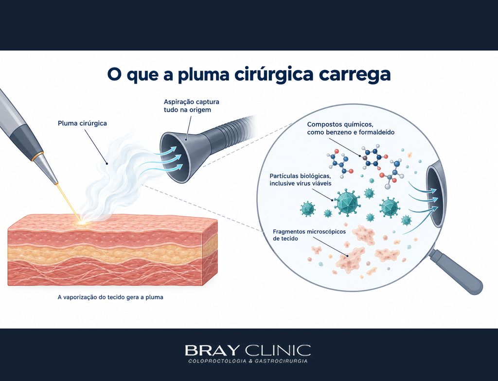 Fumaça cirúrgica, o bastidor da sala de cirurgia que diz muito sobre quem cuida de você