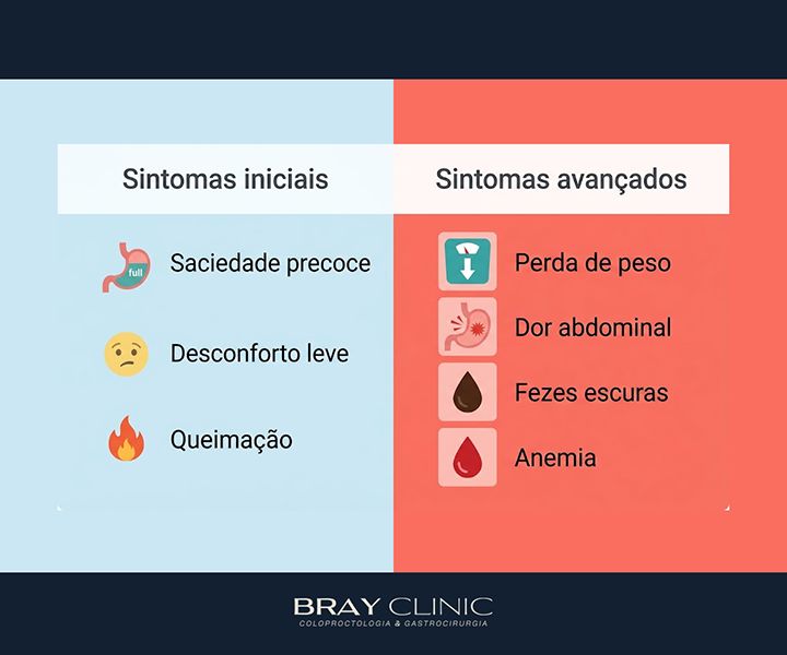 Como identificar os sinais do câncer de estômago e quando buscar ajuda