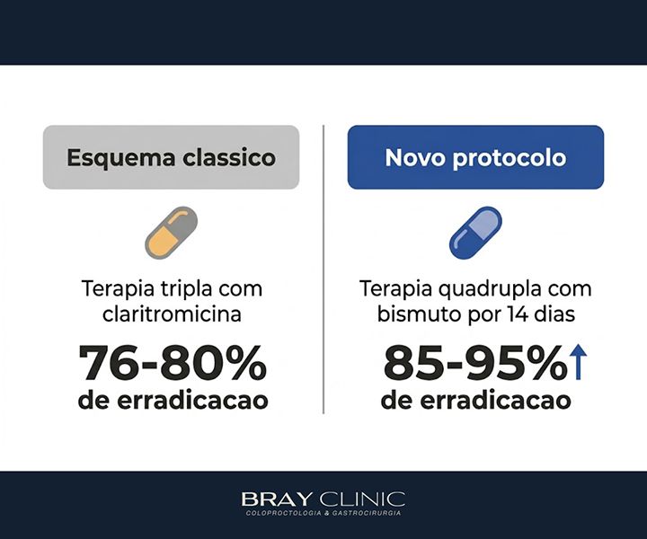 H. pylori: o que mudou no tratamento e como erradicar a bactéria