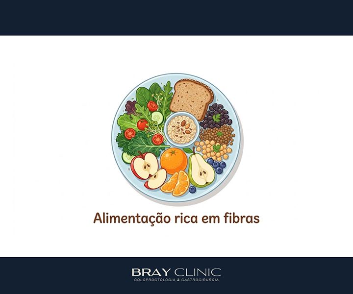 Doença diverticular do cólon: entenda o que são os divertículos e quando eles se tornam um problema