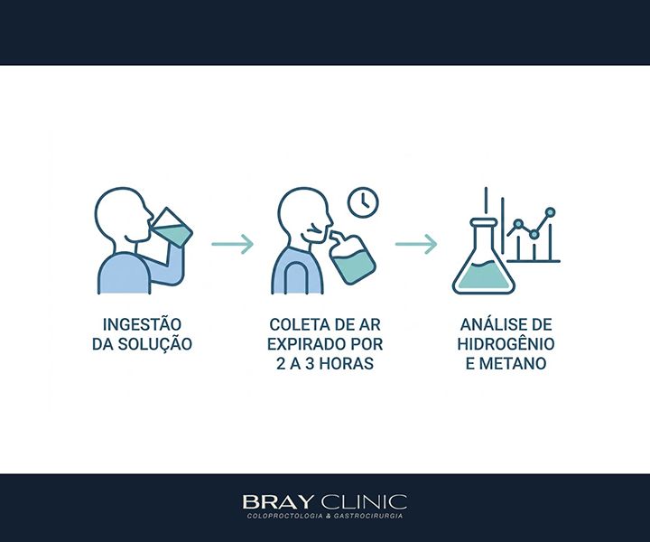 SIBO: entenda o supercrescimento bacteriano no intestino delgado e saiba como tratar