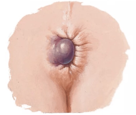 Uma imagem contendo rosa, frutas, neve, azulDescrição gerada automaticamente