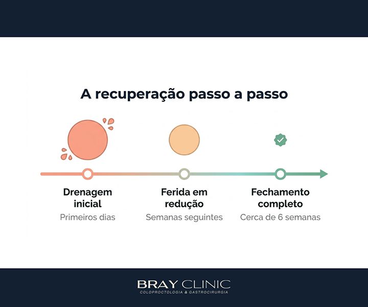 Cirurgia de fístula anal: o guia completo da recuperação até a cicatrização total