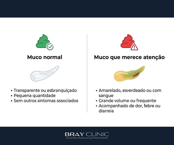 Muco nas fezes: descubra as causas e saiba quando procurar um médico