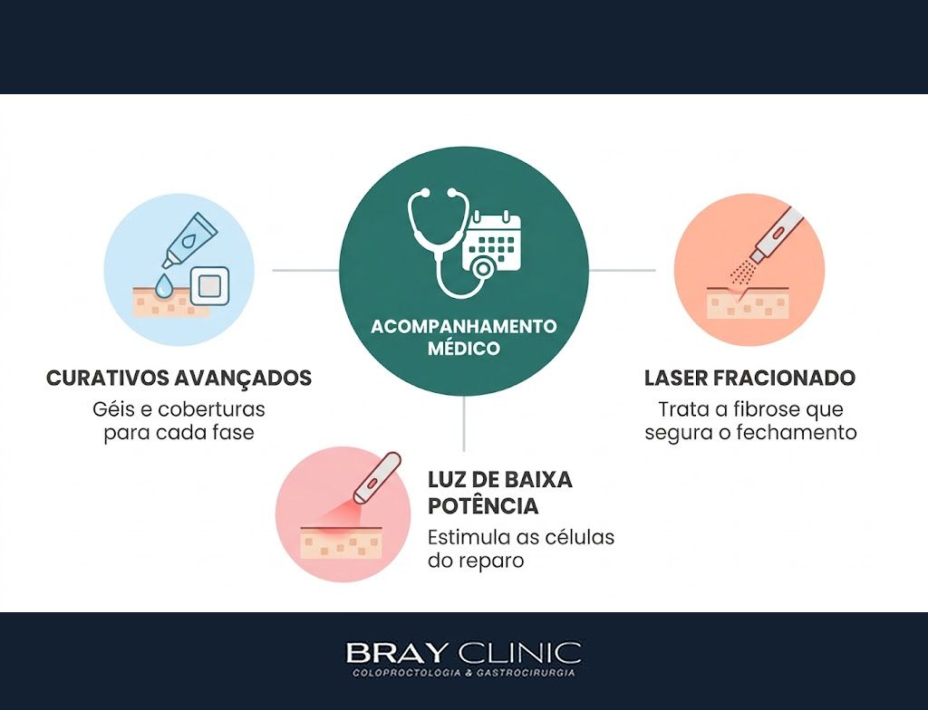 Cicatrização do cisto pilonidal, como acelerar o processo e o que fazer quando a ferida não fecha