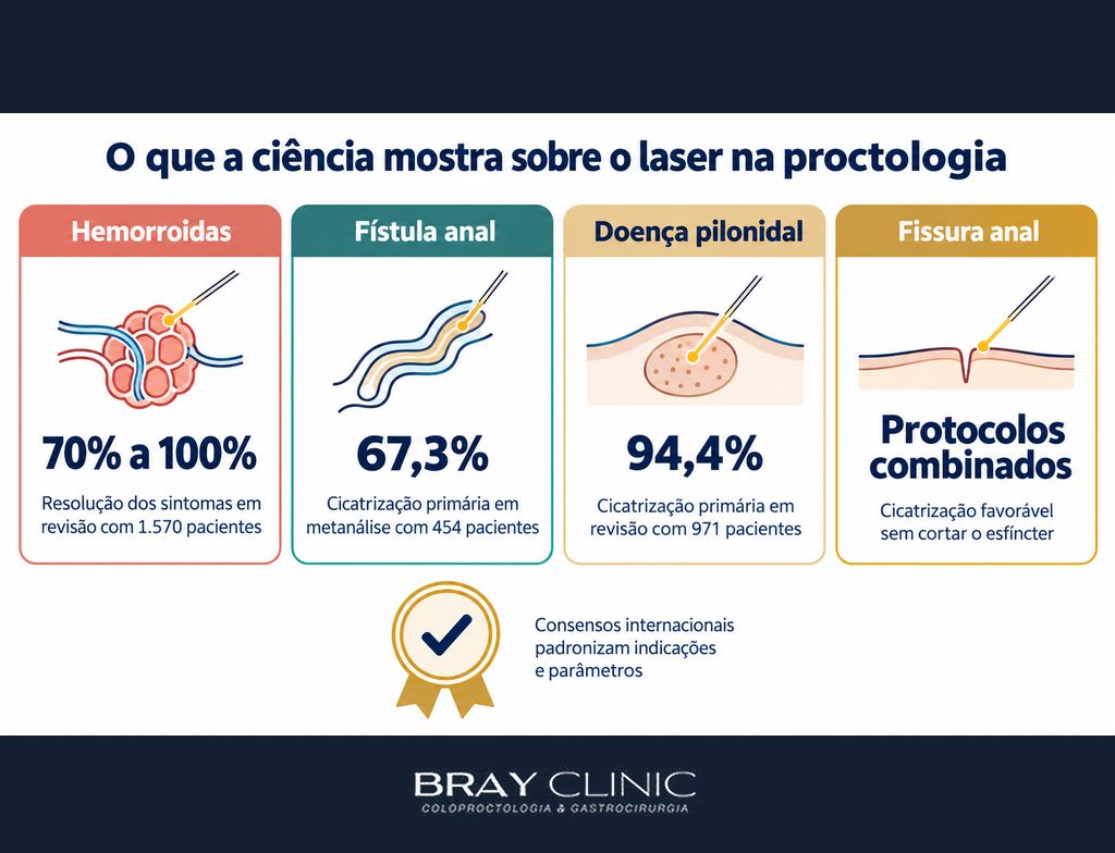O laser na proctologia passado a limpo, os números que a ciência já confirmou